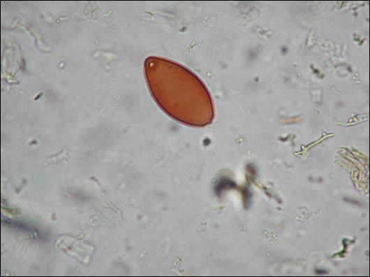 Figure 31: Pollen-based studies which consider the impact of people - and their domestic livestock - on past landscapes may now also include the analysis of coprophilous fungal spores, such as Podospora-type (HdV-368, pictured here), ©J Schofield.