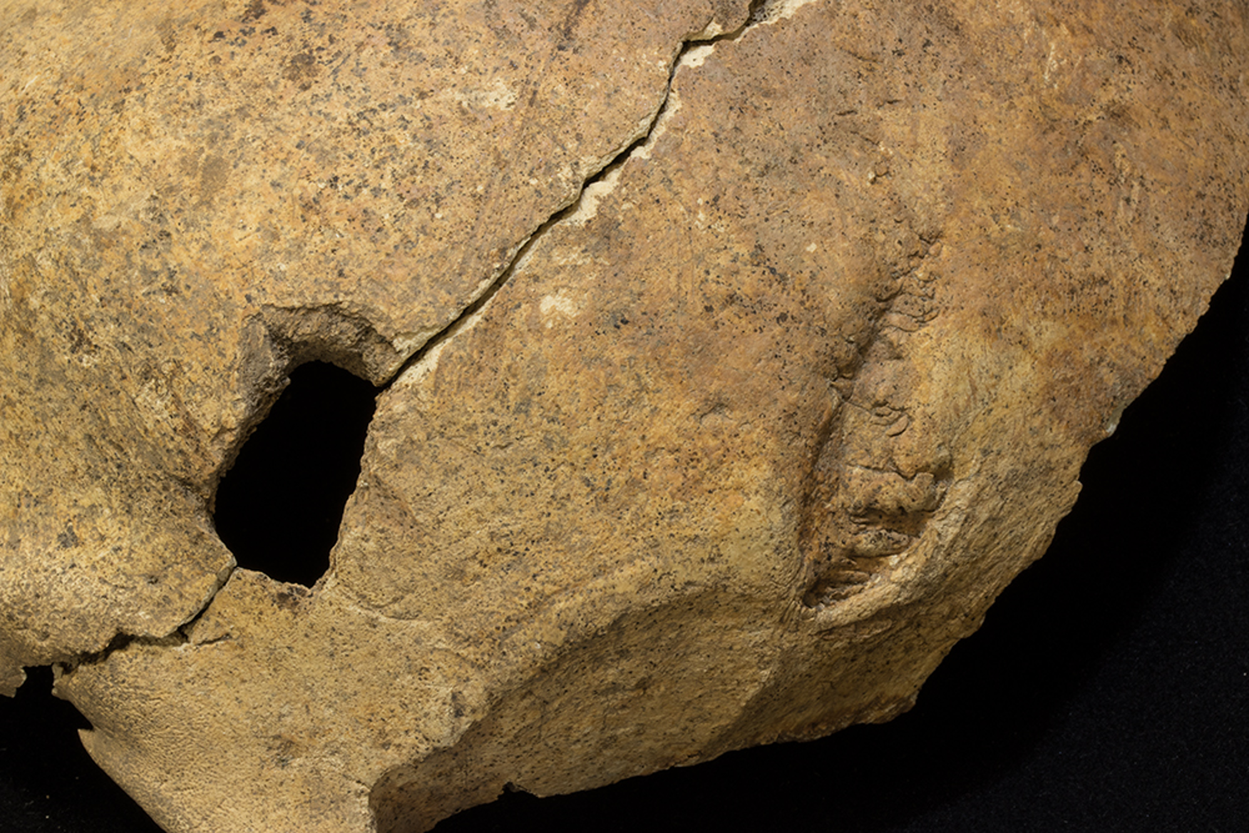 A close-up of a piece of skull with a rectangular hole. The bone is split diagonally either side of the hole.