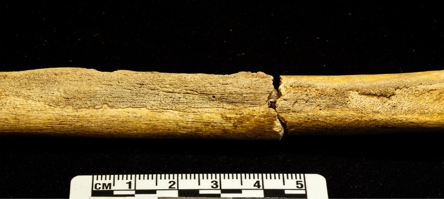 A long yellow rectangular bone which is broken into two pieces.