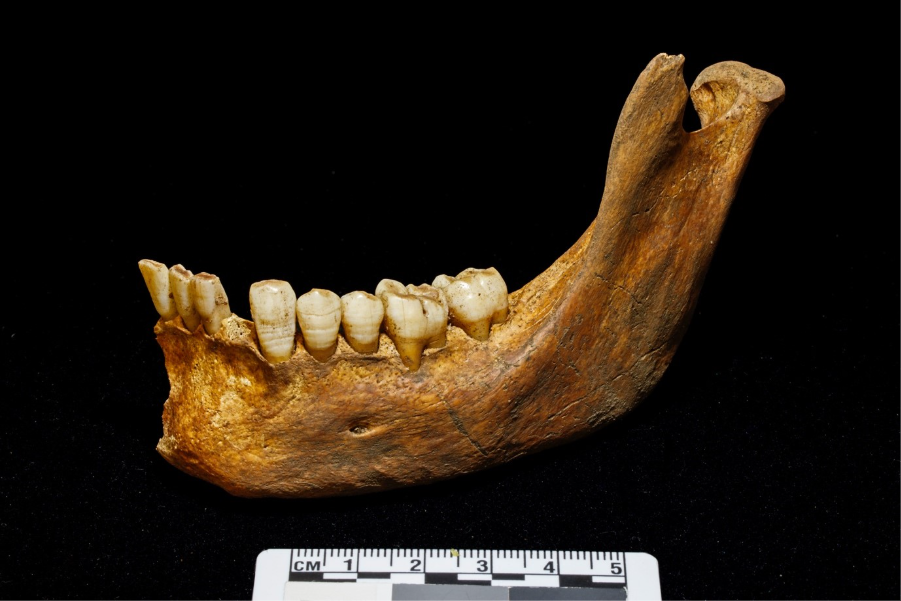 The right side on a lower jaw bone with eight teeth attached to a dark yellow-brown jaw.
