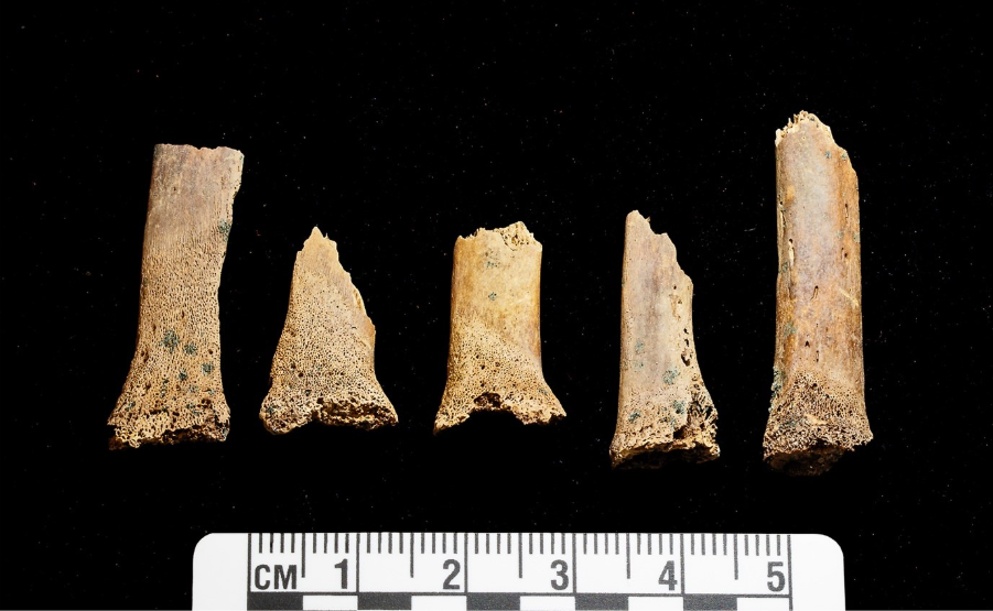 Five fragments of brown, rectangular bone, broken and snapped in different places and lying vertically in a horizontal row on a black background.