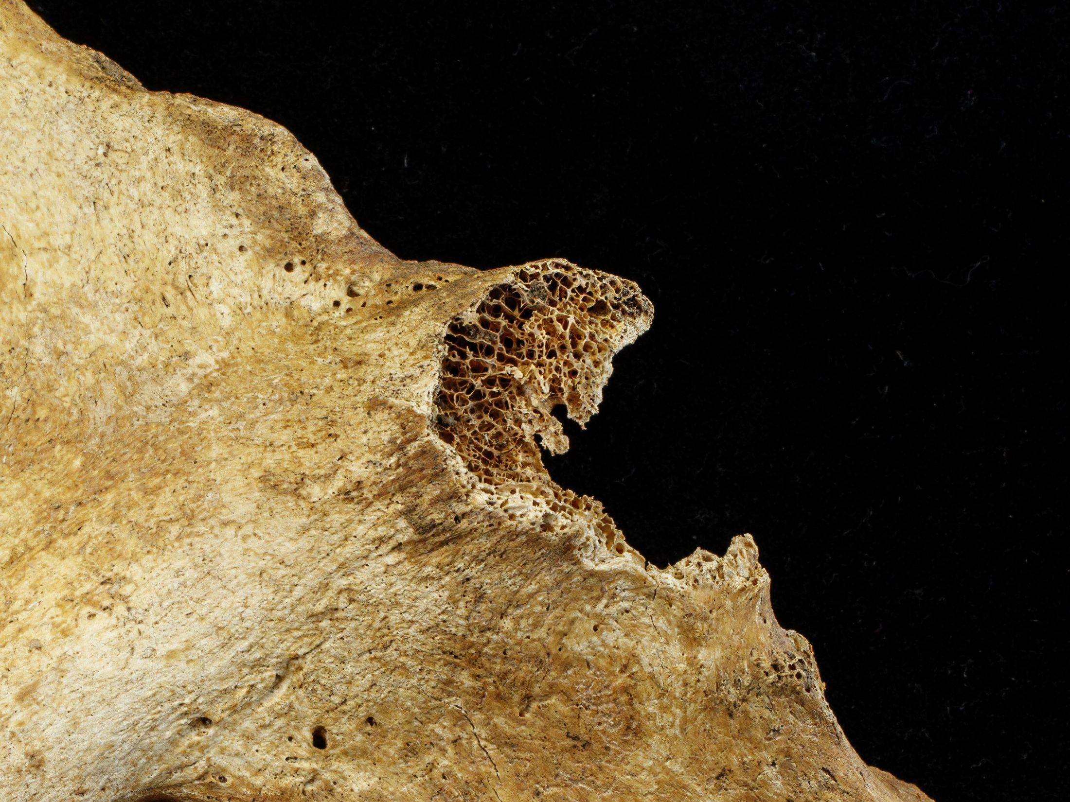 Close up of spongy texture area in a hip bone