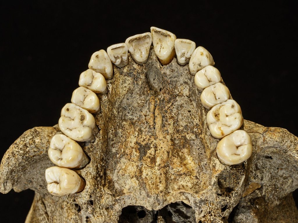 Image of a top jaw showing the top teeth from below. The bone is yellow and brown and shows a full set of white-yellow teeth